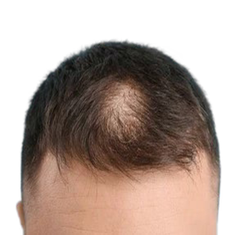 Suffly Roll-On Saç Serumu