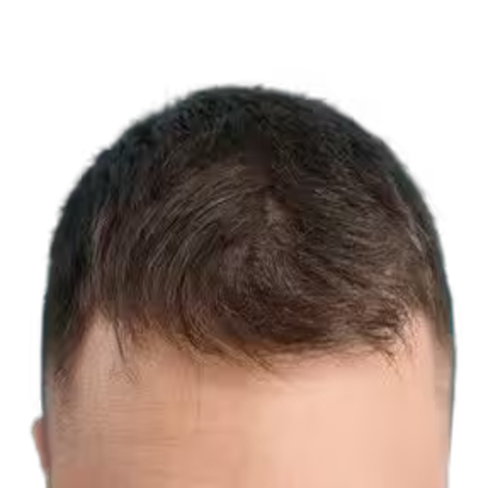 Suffly Roll-On Saç Serumu